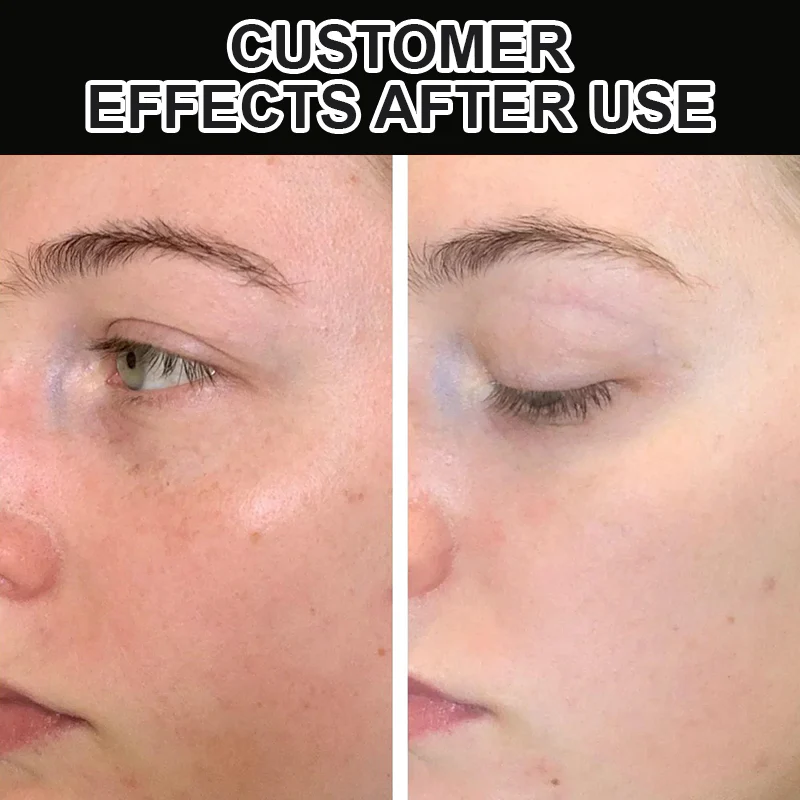 Fivfivgo™ Crème Raffermissante Intensive De Jour Et De Nuit