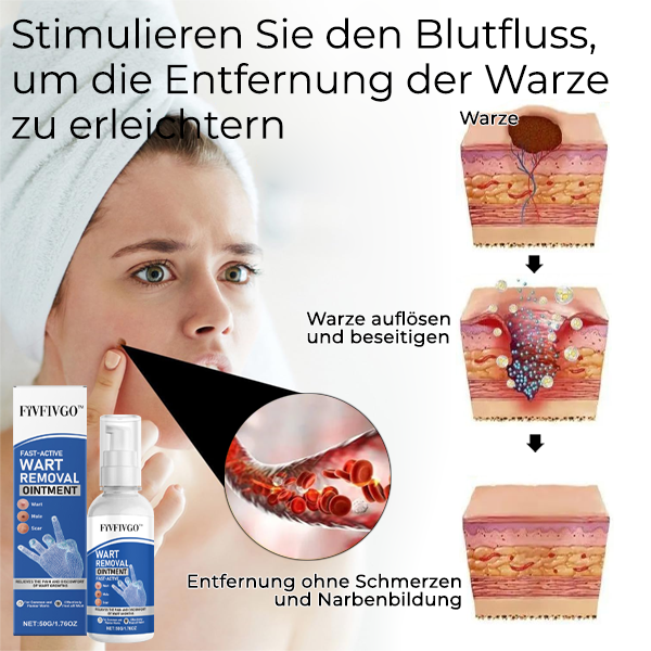 Fivfivgo™ Schnell wirksame Salbe zur Entfernung von Warzen