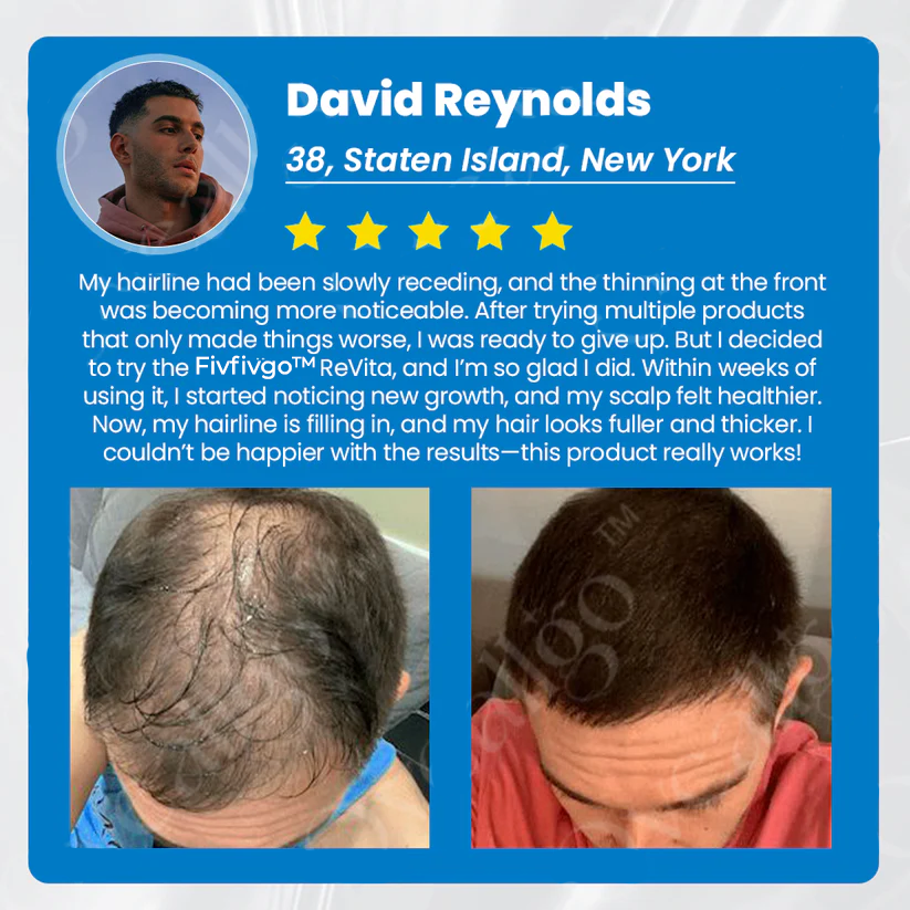 Fivfivgo™ ReVita Haarwachstumsserum - Minoxidil Topische Lösung USP, 5% mit Biotin