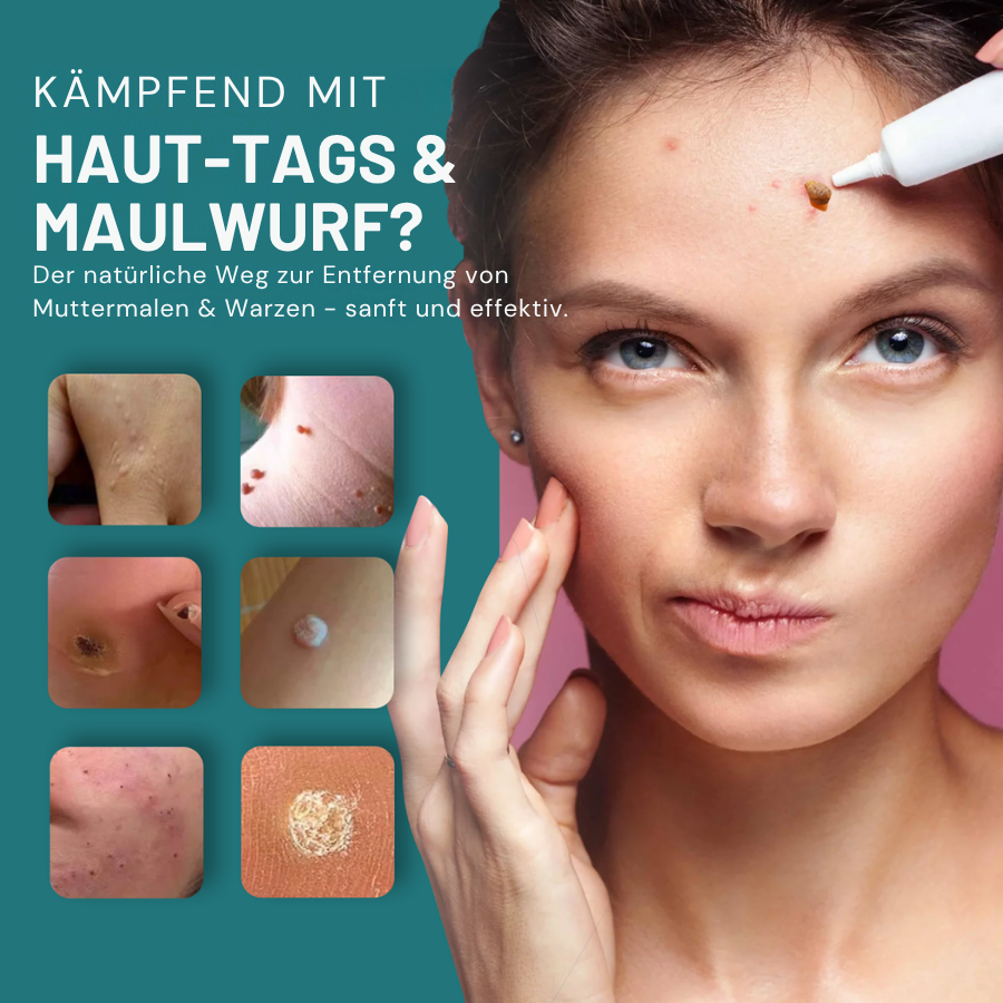 Fivfivgo® NatureStore Maulwurf und Warze Entfernungsgel