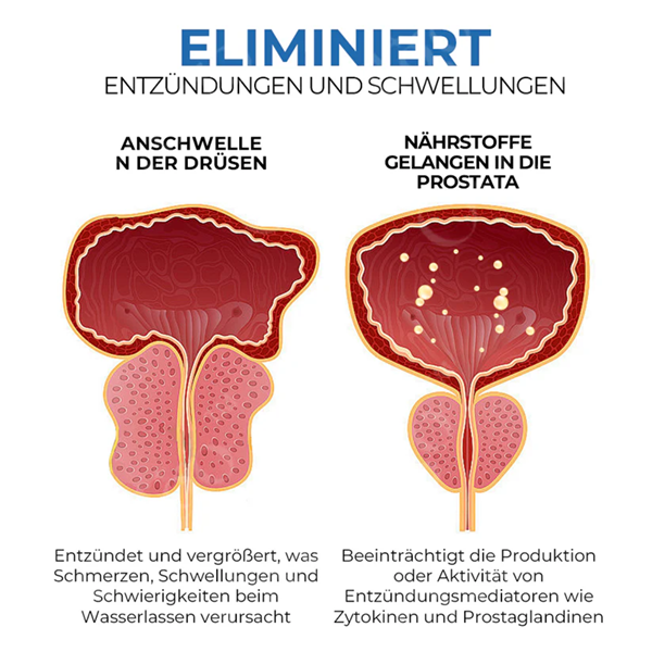 Fivfivgo™ BeeBoom Naseninhalator für die Prostatagesundheit