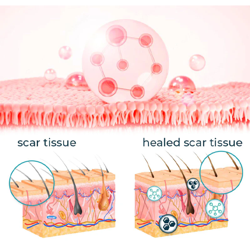 Fivfivgo™ Advanced Scar Removal Gel