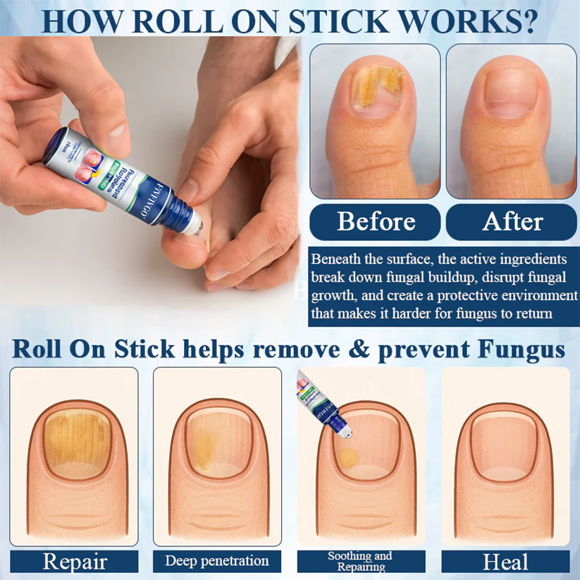Fivfivgo® FungaGuard Botanica Roll On Stick