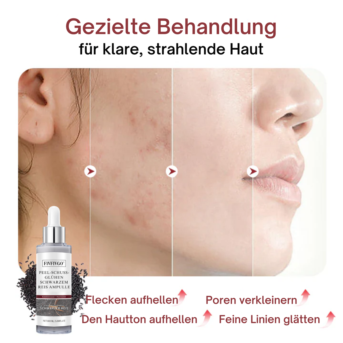 Fivfivgo® Peel-Schuss-Glühen Schwarzem Reis Ampulle
