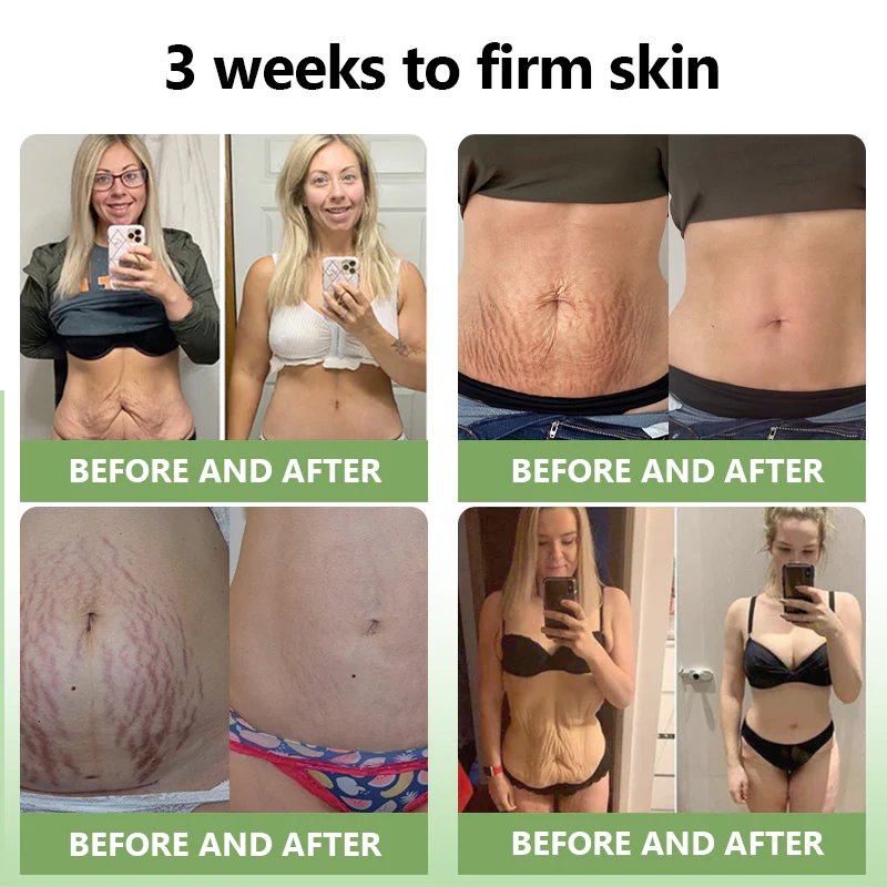 Fivfivgo™ Luxe Collagen Straffende Creme