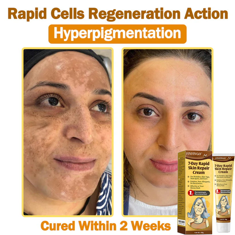 Fivfivgo™ 7-Day Rapid Skin Repaur Cream