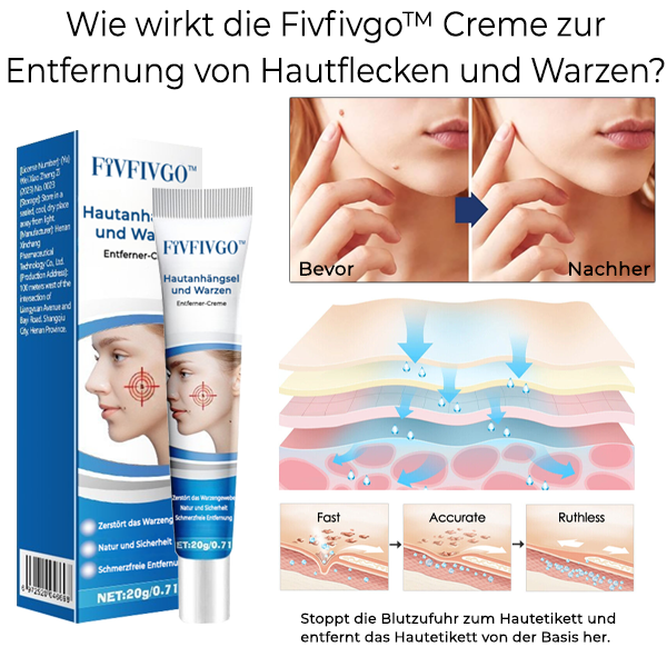 Fivfivgo™ Creme zur Entfernung von Hautflecken und Warzen