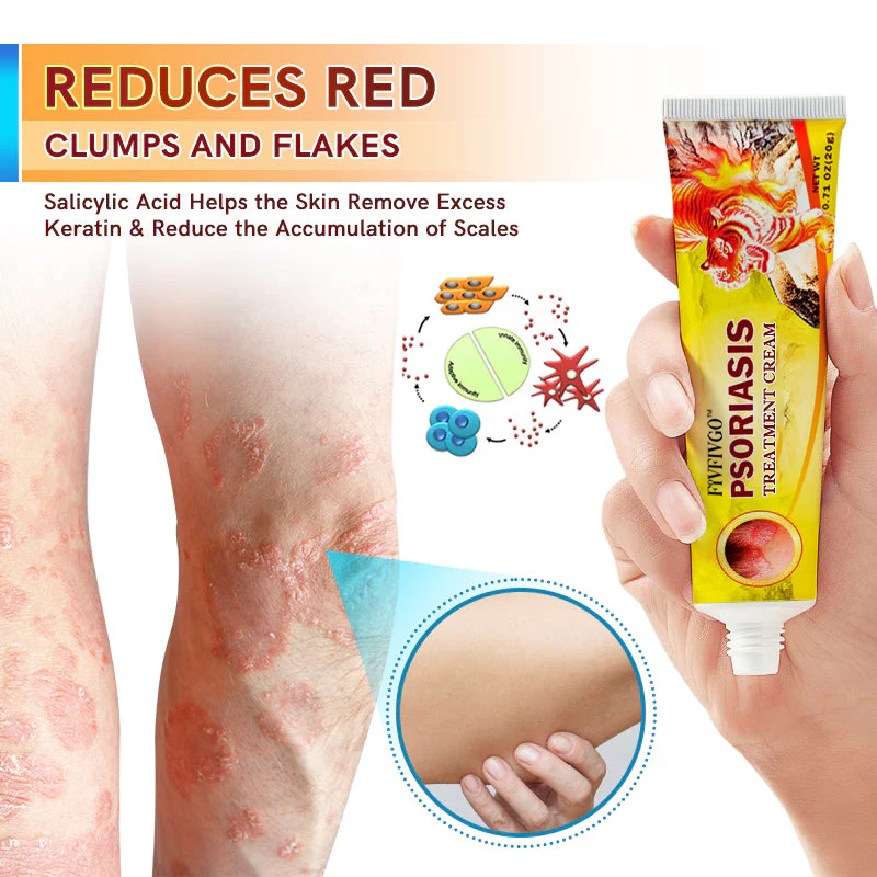 Fivfivgo™ Psoriasis Treatment Cream