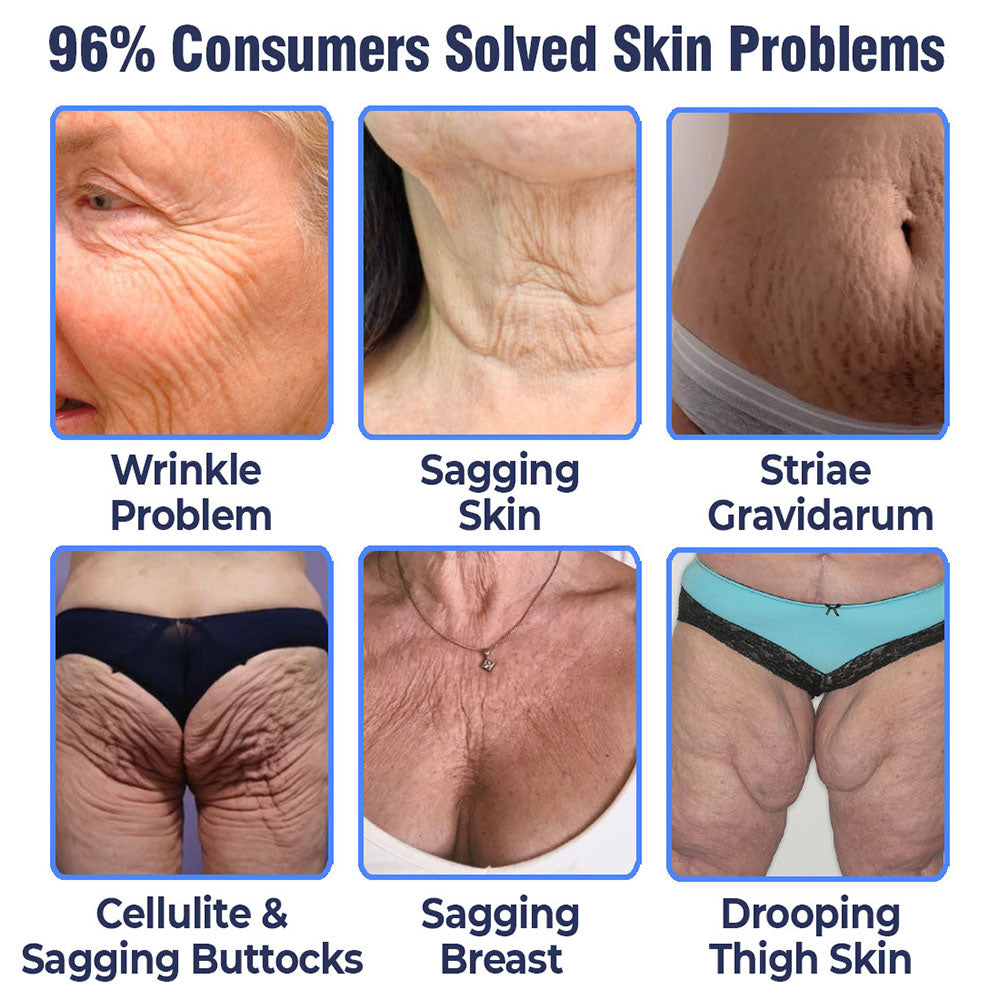 Fivfivgo™ Advanced Tightening & Wrinkles Reducing Lotion