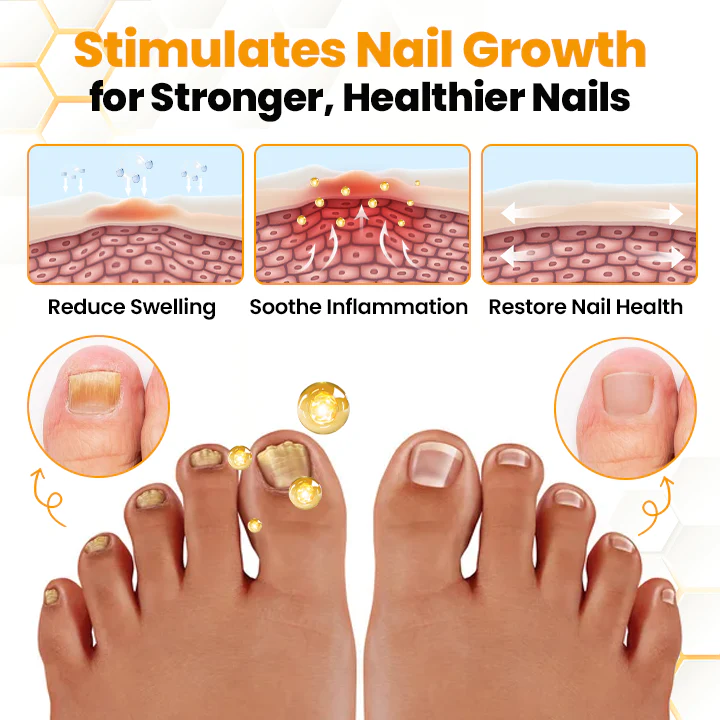Fivfivgo™ BeeVenom Anti-Fungal Nail Renewal Oil