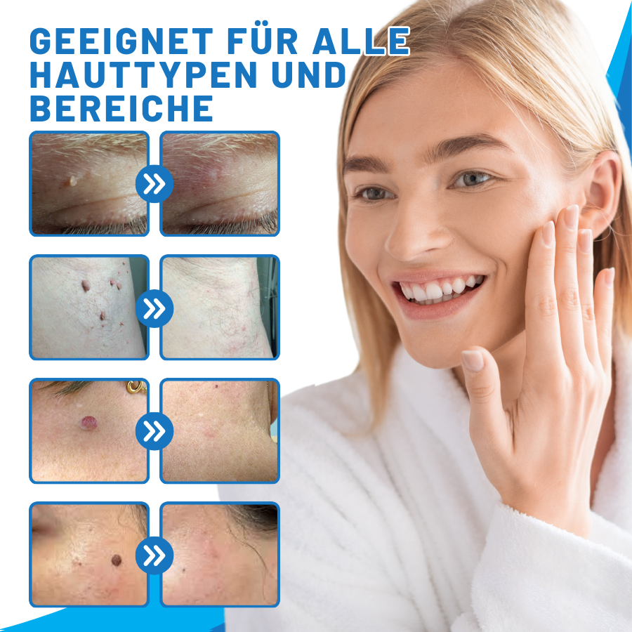 Fivfivgo™ Zu Hause Haut Tag Einfädeln Stift
