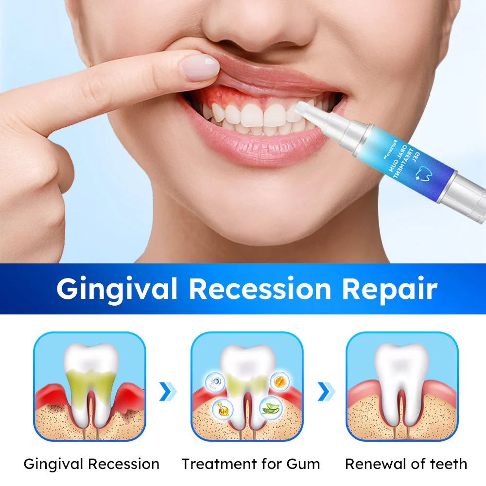 Fivfivgo™ Gel de gomme pour traitement oral