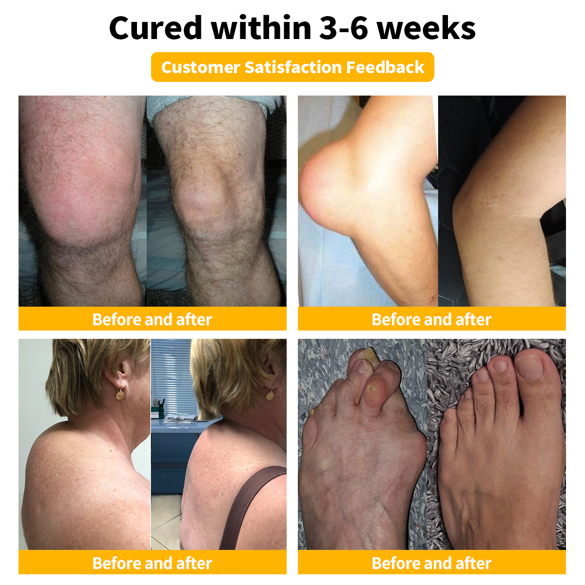 NovaRX® Bee Venom Joint Repair Cream