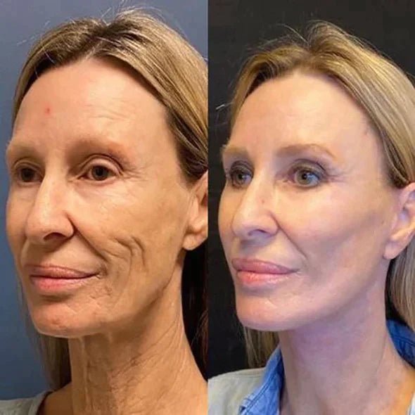 Fivfivgo™ Vitamin C Anti-Ageing Gesichtsserum