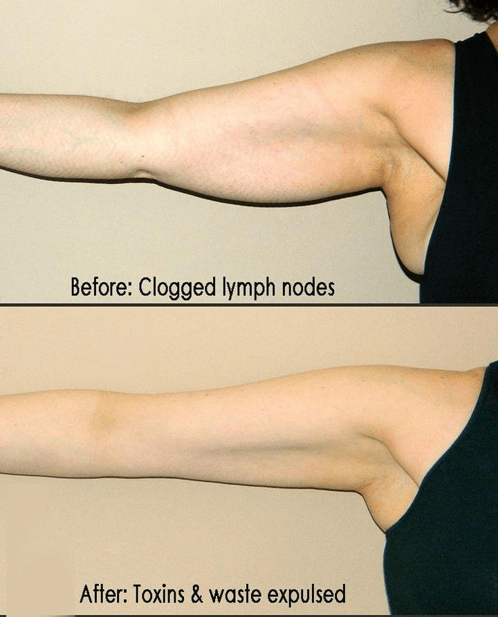 Nutrispot™ Neck Lymphatic Detox Patch (Set of 10)