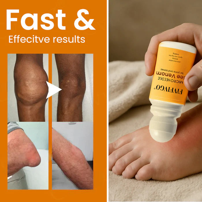 Fivfivgo® Microneedle Bee Venom for Joints and Bones