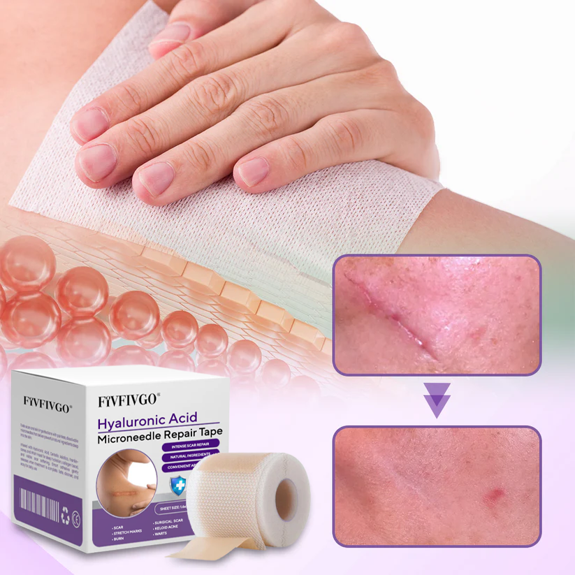 Fivfivgo® Hyaluronic Acid Microneedle Repair Tape