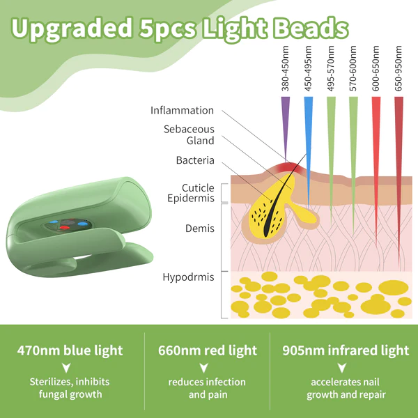 Fivfivgo™ Dispositif laser antifongique