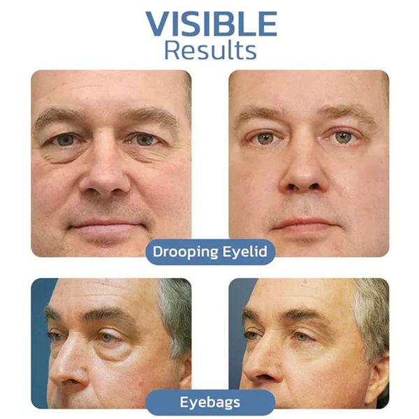 Fivfivgo™ Awaken Peptide Lifting Augengel