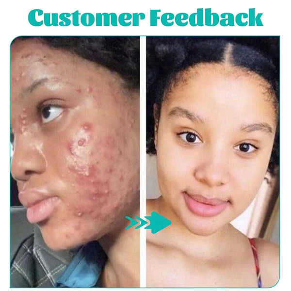 Fivfivgo™ Green Tea Gentle Cleansing Oil Control Mask