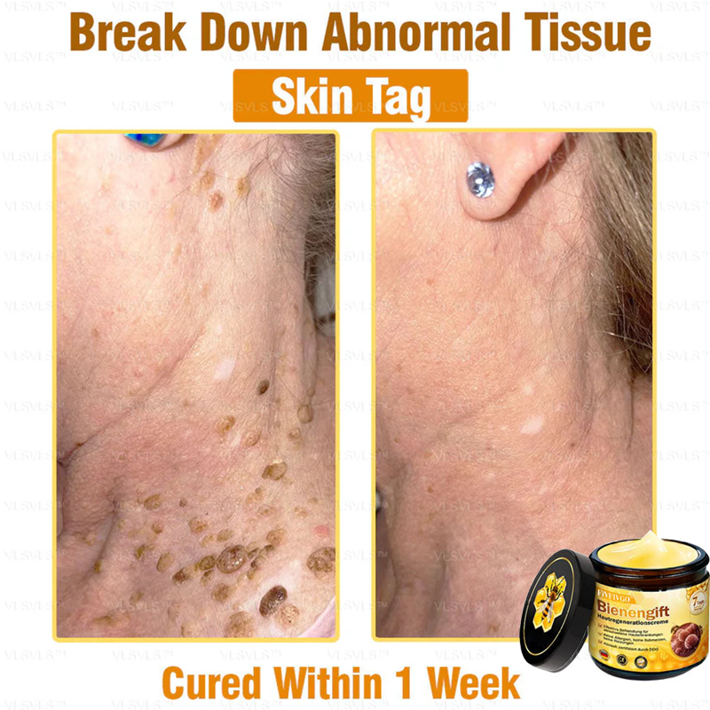 Fivfivgo™ Bee Venom Skin Regeneration Cream