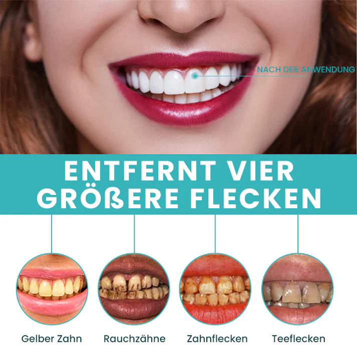 Fivfivgo® Sofortige Zahnaufhellungsfarbe