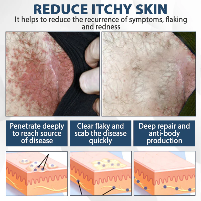 Fivfivgo® ManGuard HPV WART Healing Cream