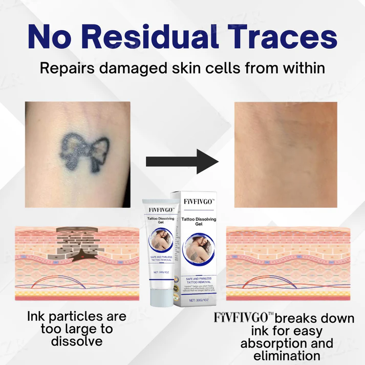 Fivfivgo™ Tattoo Vanishing Gel