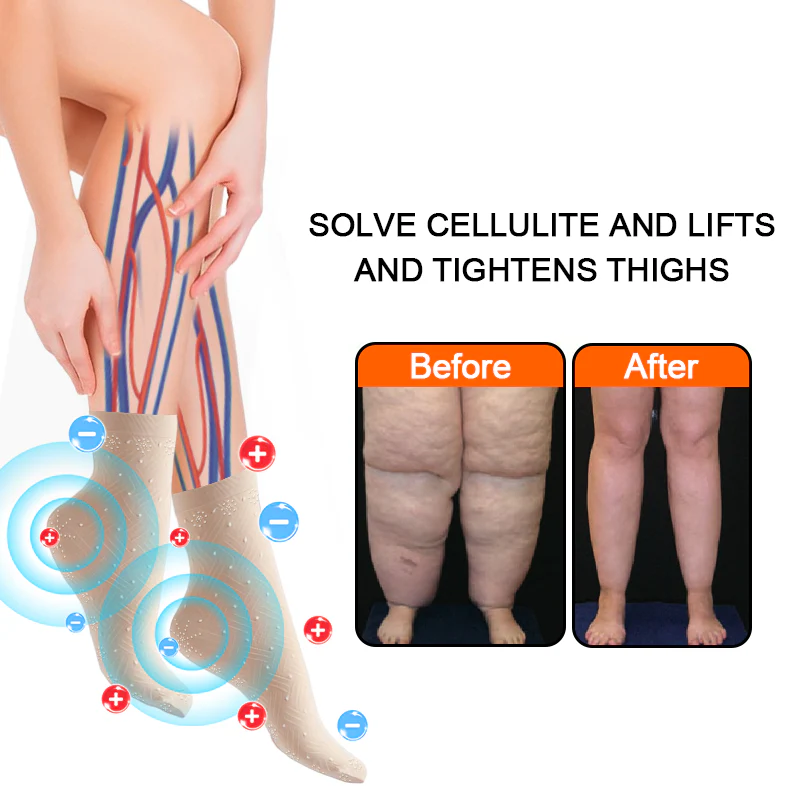 Fivfivgo™ Ice Silk Ion Fiber Repair Sculpting Socken