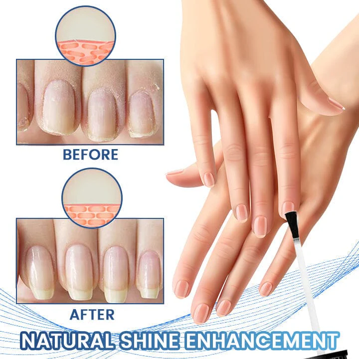 Fivfivgo™ FungiFix Nail Fungus Treatment Care Fluid