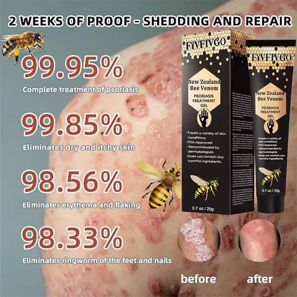 Gel de traitement du psoriasis au venin d'abeille de Nouvelle-Zélande Fivfivgo™
