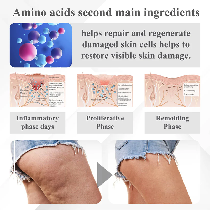 Fivfivgo™ Insulin Körperformungs-Creme