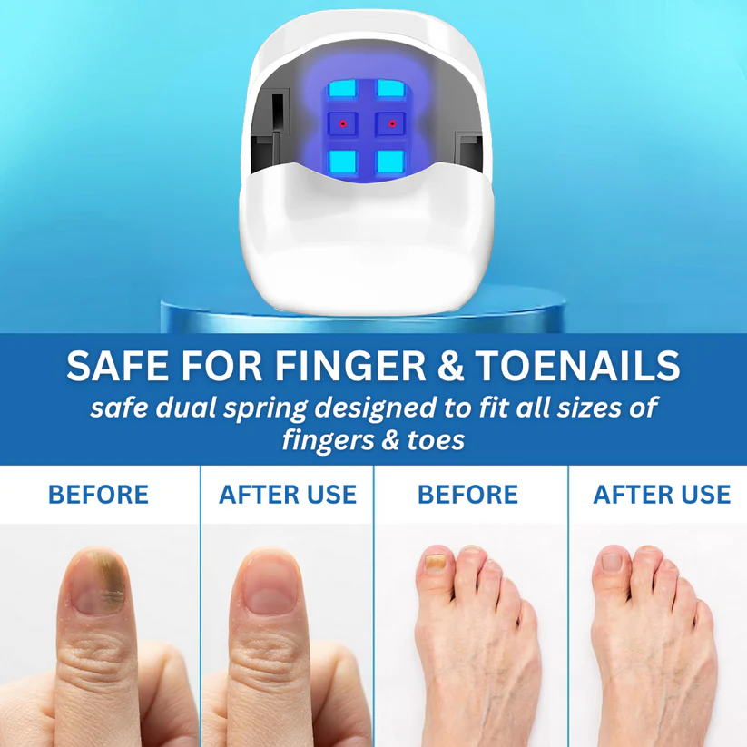 Bikenda® Nail Fungus Laser Treatment Device