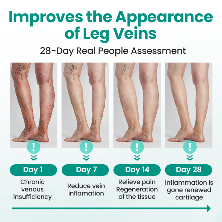 Fivfivgo® LegRenew Varicose Veins Patch
