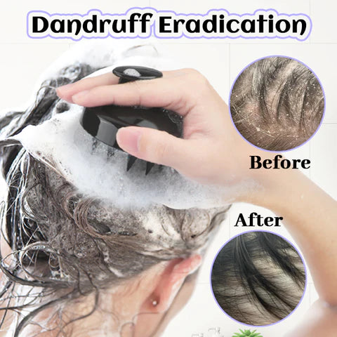 Fivfivgo™ SootheScalp Pro Massager Brush