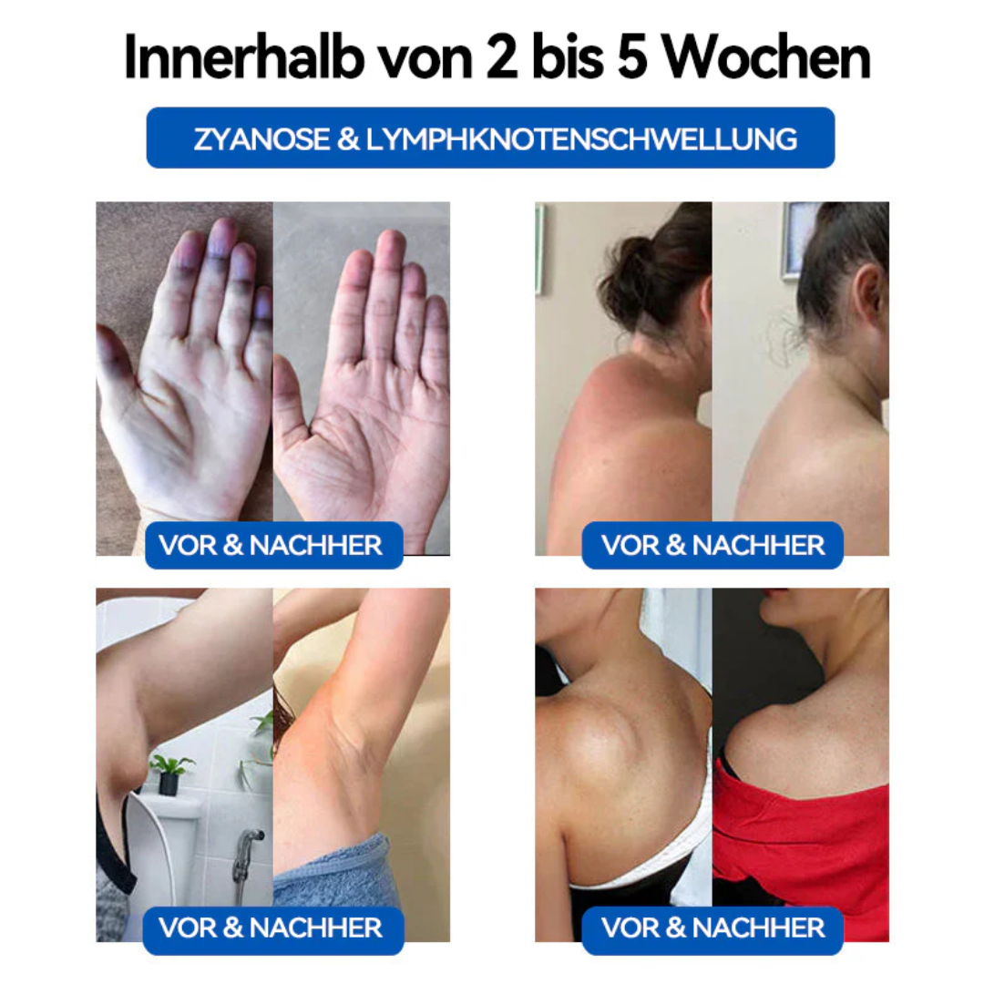 Fivfivgo™ Ultraschall-Fettsprengung und Fern-Infrarot-Blutzucker-Balance-Detox-Armband