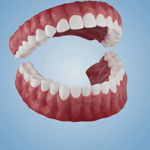 Bikenda® Advanced Customised Full Denture Set