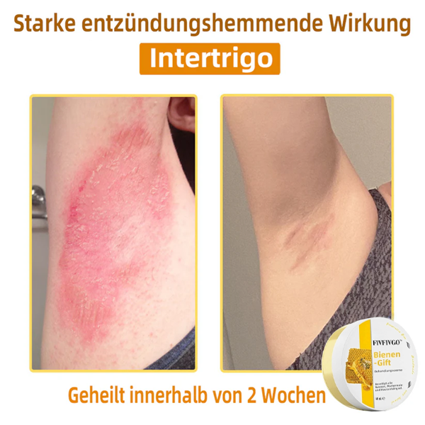 Fivfivgo™ Bienengift-Therapie-Creme