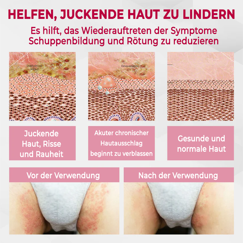Fivfivgo® Genitalien der Frau HPV-Heilcreme