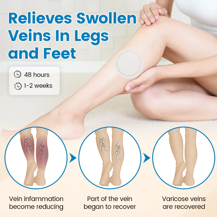 Fivfivgo® VeinEase Microneedle Patch (Advanced Circulation Support for Varicose & Spider Veins)