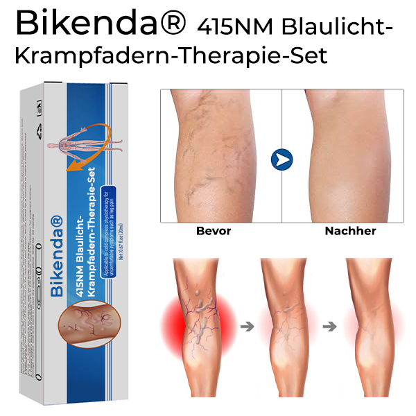 Bikenda® 415NM Blaulicht-Krampfadern-Therapie-Set