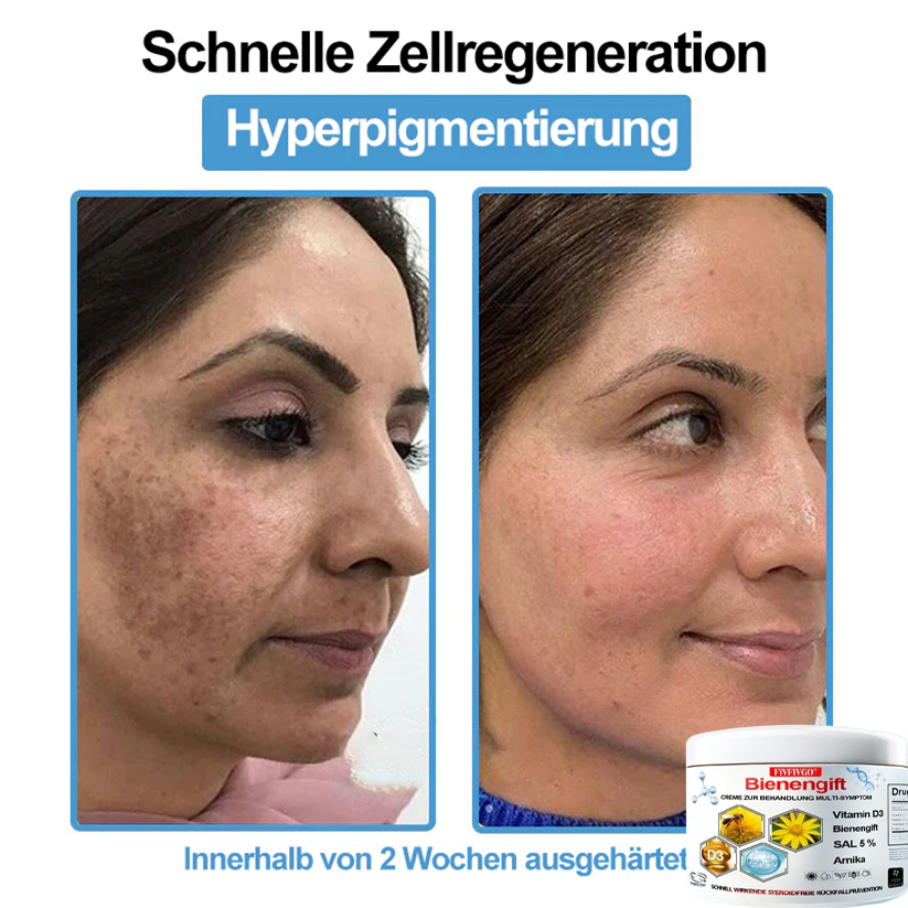 Fivfivgo™ Bienengift Creme Zur Behandlung Multi-symptom