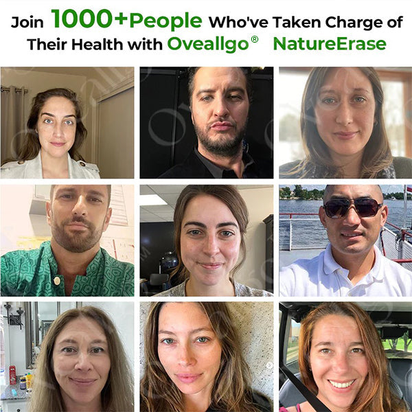 ✅ Official Store: Oveallgo® NatureErase Instant Alligator Oil Mole & Spot Cream