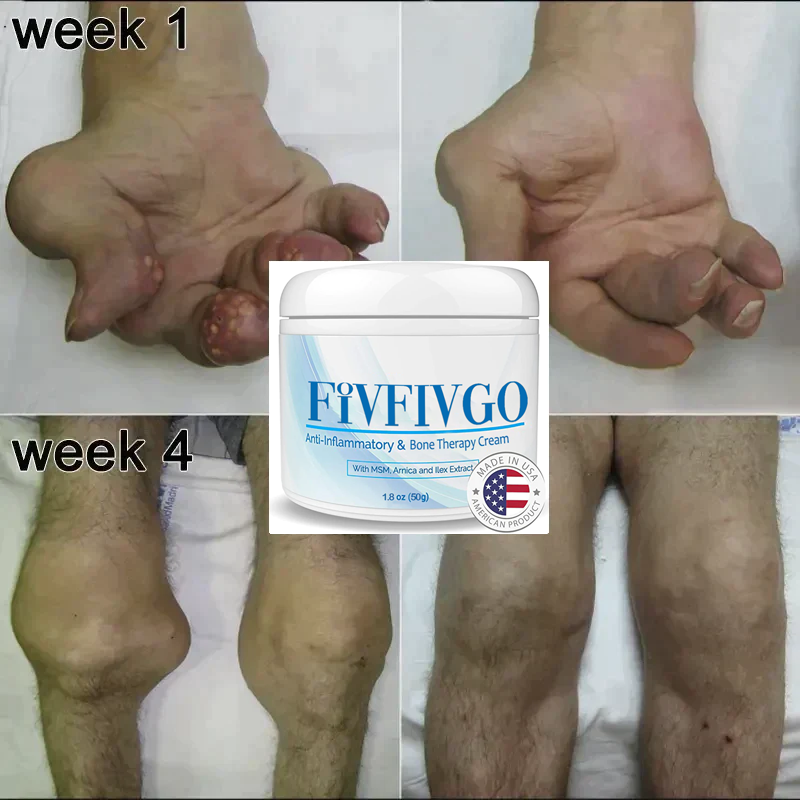 Fivfivgo™ Crème de thérapie articulaire et osseuse