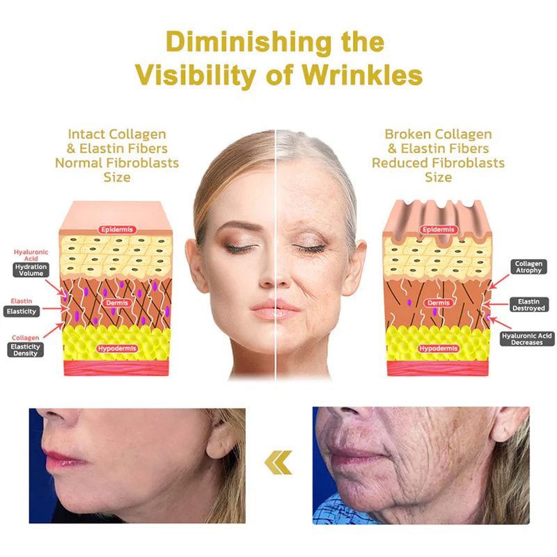 Fivfivgo™ Wrinkle Removel Cream (Address Crepe & Sagging)