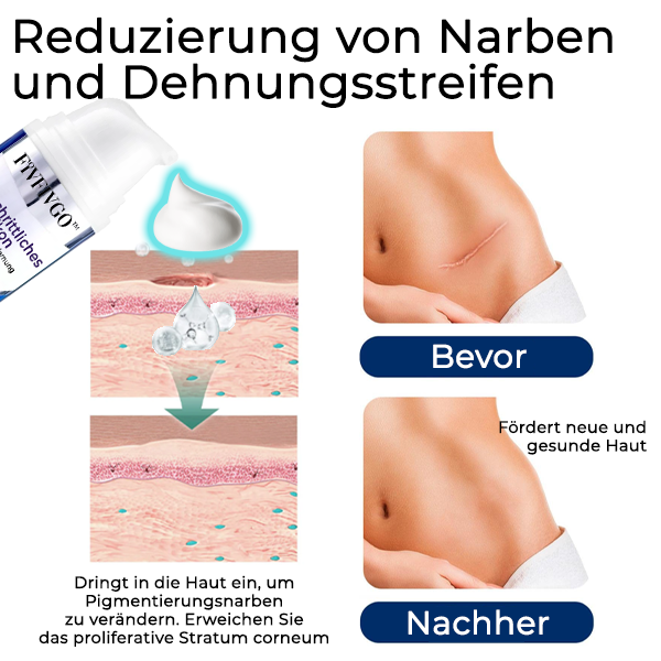 Fivfivgo™ Fortschrittliches Silikon-Gel zur Narbenentfernung