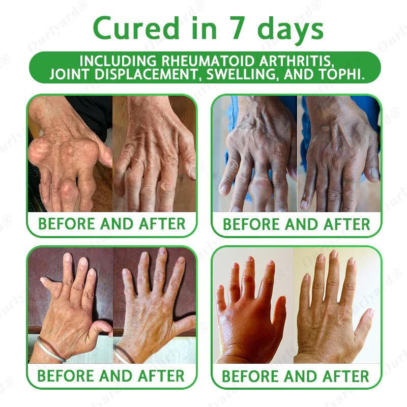 NovaRX® Advanced Magnesium & Emu Oil Massage Pain Relief Gel