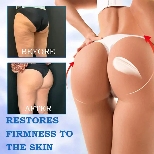 Fivfivgo™ Advanced SkinTightening Rejuvenating Cream: Restore Skin Elasticity