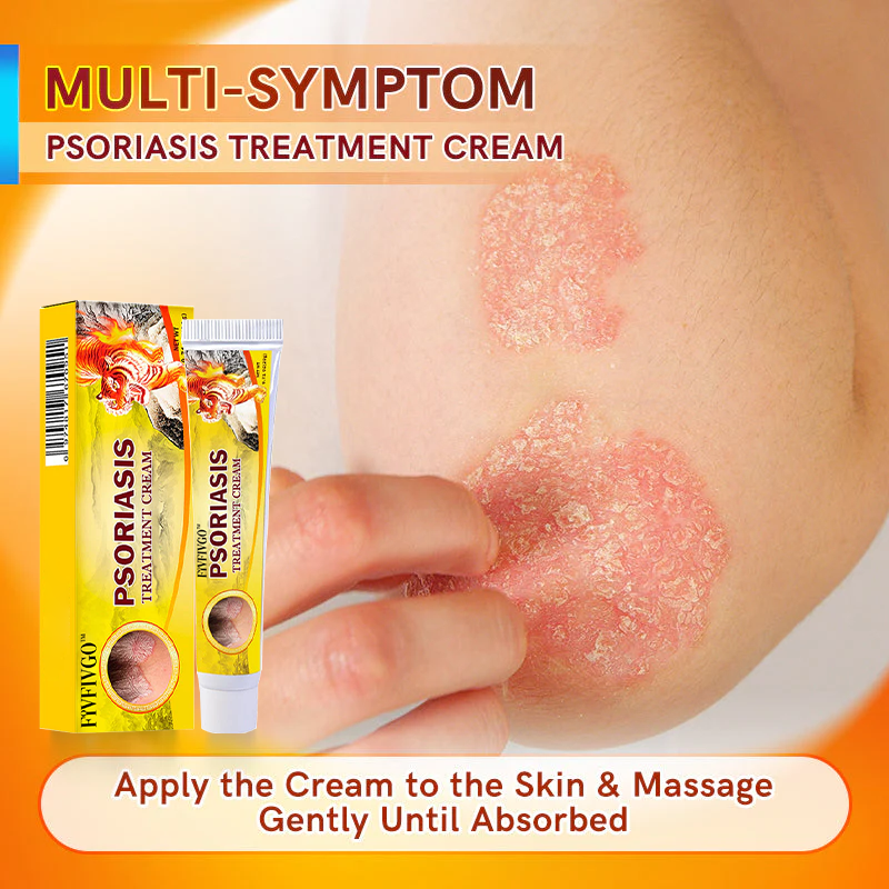Fivfivgo™ Psoriasis Treatment Cream