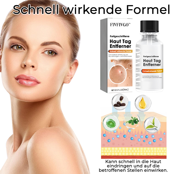 Fivfivgo™ Fortgeschrittene Haut Tag Entferner - Schnell wirkende Formel